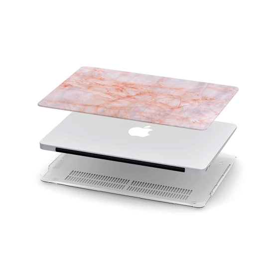 Macbook Hard Shell Case - Pink Granite